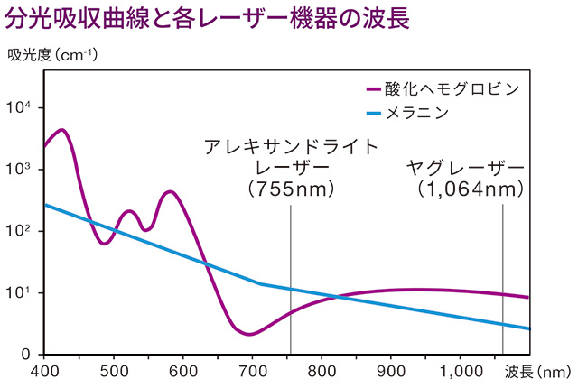 分光吸収曲線と各レーザー機器の波長